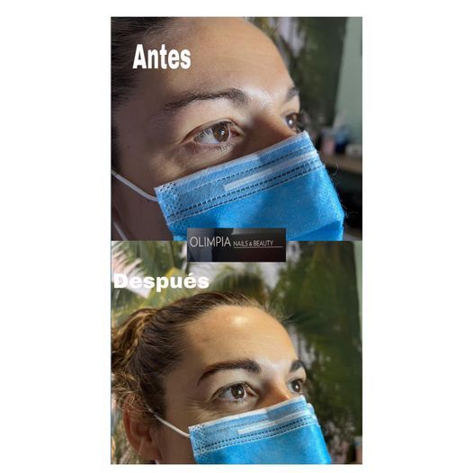 Antes y despues tratamiento de pestañas